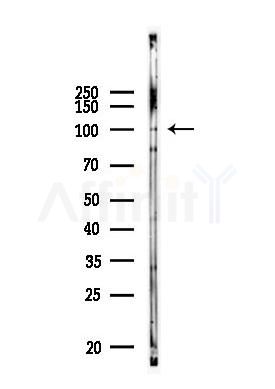 CCSER1 Antibody - Western blot analysis of lysates from A375 cells, using CCSER1 Antibody at 1/1000 dilution.