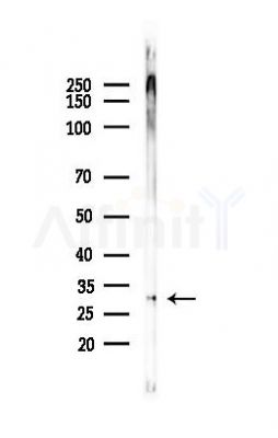 LBX1 Antibody - Western blot analysis of lysates from Mouse muscle, using LBX1 Antibody at 1/1000 dilution.
