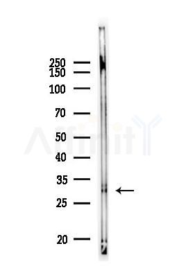 LBX1 Antibody - Western blot analysis of lysates from A375 cells, using LBX1 Antibody at 1/1000 dilution.