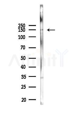 UTY Antibody - Western blot analysis of lysates from A375 cells, using UTY Antibody at 1/1000 dilution.