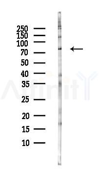 BAHD1 Antibody - Western blot analysis of lysates from HepG2 cells(LPS, 4h treatment), using BAHD1 Antibody at 1/1000 dilution.