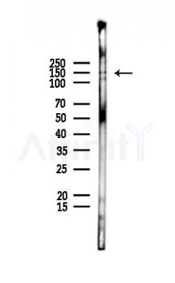 KIF7 Antibody - Western blot analysis of lysates from EC304 cells(UV,30min treatment), using KIF7 Antibody at 1/1000 dilution.