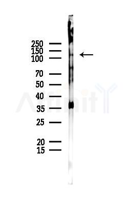 INPP5F Antibody - Western blot analysis of lysates from EC304 cells(UV,30min treatment), using INPP5F Antibody at 1/1000 dilution.