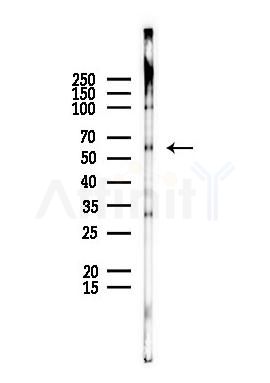 SGSH Antibody - Western blot analysis of lysates from EC304 cells(UV,30min treatment), using SGSH Antibody at 1/1000 dilution.