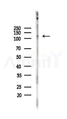 LIMCH1 Antibody - Western blot analysis of lysates from Mouse lung, using LIMCH1 Antibody at 1/1000 dilution.