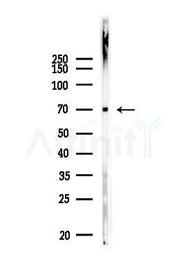 EPM2AIP1 Antibody - Western blot analysis of lysates from A375 cells, using EPM2AIP1 Antibody at 1/1000 dilution.