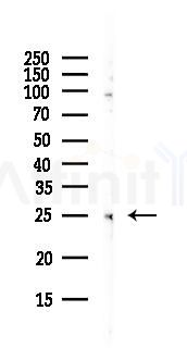 CHMP5 Antibody - Western blot analysis of lysates from HepG2 cells(LPS, 4h treatment), using CHMP5 Antibody at 1/1000 dilution.