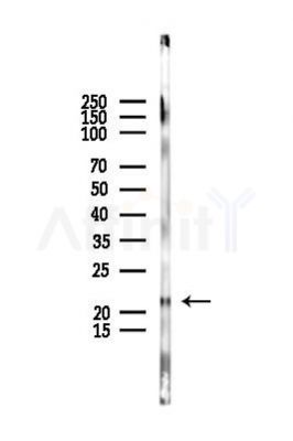 MZB1 Antibody - Western blot analysis of lysates from EC304 cells(UV,30min treatment), using MZB1 Antibody at 1/1000 dilution.
