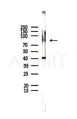 SCYL3 Antibody - Western blot analysis of lysates from EC304 cells(UV,30min treatment), using SCYL3 Antibody at 1/1000 dilution.