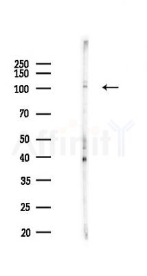 ATP6V0A4 Antibody - Western blot analysis of lysates from COLO205 cells(heat-shock,45min treatment), using ATP6V0A4 Antibody at 1/1000 dilution.