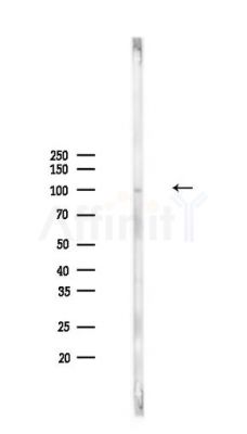 ATP6V0A4 Antibody - Western blot analysis of lysates from PC12 cells, using ATP6V0A4 Antibody at 1/1000 dilution.