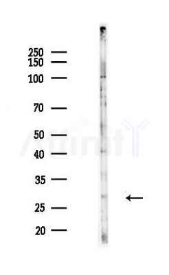 CTDSP2 Antibody - Western blot analysis of lysates from COLO205 cells(heat-shock,45min treatment), using CTDSP2 Antibody at 1/1000 dilution.