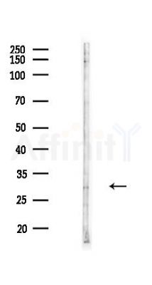 BPGM Antibody - Western blot analysis of lysates from Hela cells(heat-shock,45min treatment), using BPGM Antibody at 1/1000 dilution.