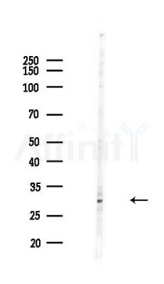 BPGM Antibody - Western blot analysis of lysates from COLO205 cells(heat-shock,45min treatment), using BPGM Antibody at 1/1000 dilution.