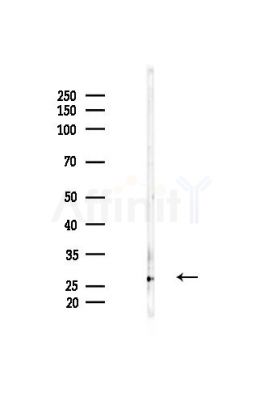TMED2 Antibody - Western blot analysis of lysates from Mouse liver, using TMED2 Antibody at 1/1000 dilution.
