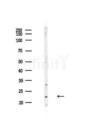 TMED2 Antibody - Western blot analysis of lysates from Hela cells(heat-shock,45min treatment), using TMED2 Antibody at 1/1000 dilution.