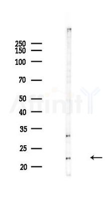 TMED2 Antibody - Western blot analysis of lysates from COLO205 cells(heat-shock,45min treatment), using TMED2 Antibody at 1/1000 dilution.