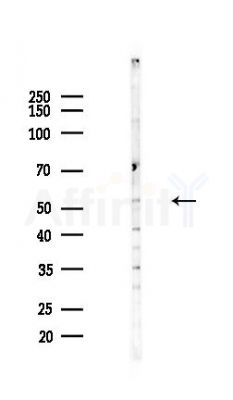 EFCAB14 Antibody - Western blot analysis of lysates from COLO205 cells(heat-shock,45min treatment), using EFCAB14 Antibody at 1/1000 dilution.