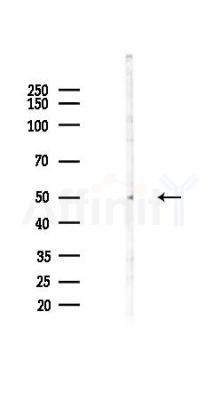 CMAS Antibody - Western blot analysis of lysates from COLO205 cells(heat-shock,45min treatment), using CMAS Antibody at 1/1000 dilution.