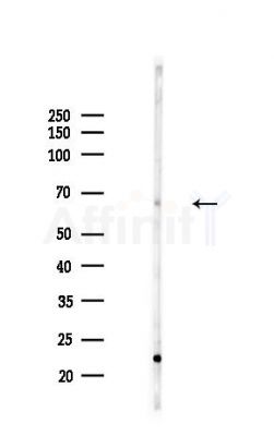 ZNF211 Antibody - Western blot analysis of lysates from Mouse liver, using ZNF211 Antibody at 1/1000 dilution.