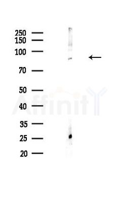 CCDC170 Antibody - Western blot analysis of lysates from Hela cells(heat-shock,45min treatment), using CCDC170 Antibody at 1/1000 dilution.
