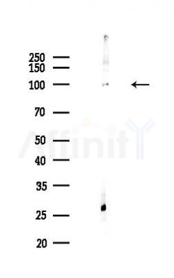 CCDC170 Antibody - Western blot analysis of lysates from COLO205 cells(heat-shock,45min treatment), using CCDC170 Antibody at 1/1000 dilution.