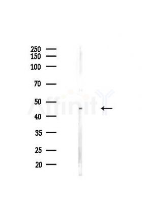 NSUN6 Antibody - Western blot analysis of lysates from Hela cells(heat-shock,45min treatment), using NSUN6 Antibody at 1/1000 dilution.