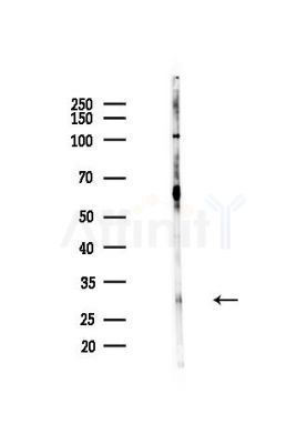 ASB9 Antibody - Western blot analysis of lysates from Hela cells(heat-shock,45min treatment), using ASB9 Antibody at 1/1000 dilution.