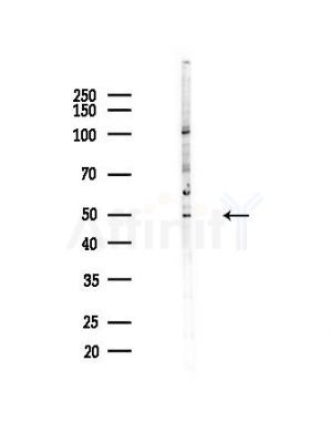 SERPINB13 Antibody - Western blot analysis of lysates from COLO205 cells(heat-shock,45min treatment), using SERPINB13 Antibody at 1/1000 dilution.