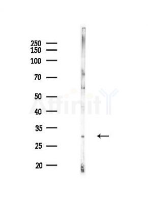 VPS28 Antibody - Western blot analysis of lysates from Hela cells(heat-shock,45min treatment), using VPS28 Antibody at 1/1000 dilution.