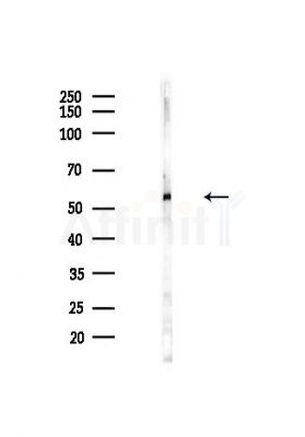 RTCB Antibody - Western blot analysis of lysates from Hela cells(heat-shock,45min treatment), using RTCB Antibody at 1/1000 dilution.