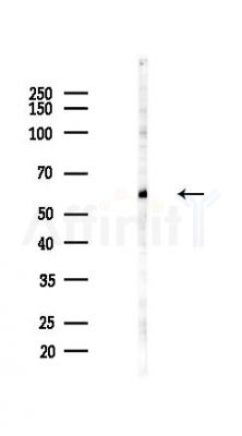 RTCB Antibody - Western blot analysis of lysates from COLO205 cells(heat-shock,45min treatment), using RTCB Antibody at 1/1000 dilution.