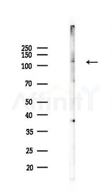 SLC12A4 Antibody - Western blot analysis of lysates from COLO205 cells(heat-shock,45min treatment), using SLC12A4 Antibody at 1/1000 dilution.