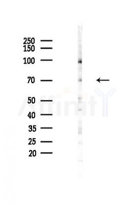 SLC5A8 Antibody - Western blot analysis of lysates from COLO205 cells(heat-shock,45min treatment), using SLC5A8 Antibody at 1/1000 dilution.