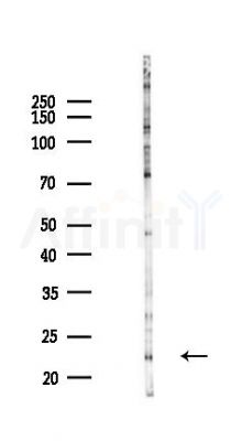 SOSTDC1 Antibody - Western blot analysis of lysates from COLO205 cells(heat-shock,45min treatment), using SOSTDC1 Antibody at 1/1000 dilution.