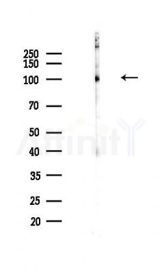 RTF1 Antibody - Western blot analysis of lysates from COLO205 cells(heat-shock,45min treatment), using RTF1 Antibody at 1/1000 dilution.