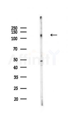HERC3 Antibody - Western blot analysis of lysates from COLO205 cells(heat-shock,45min treatment), using HERC3 Antibody at 1/1000 dilution.