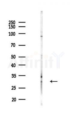 ZC4H2 Antibody - Western blot analysis of lysates from COLO205 cells(heat-shock,45min treatment), using ZC4H2 Antibody at 1/1000 dilution.