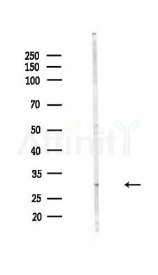 ZC4H2 Antibody - Western blot analysis of lysates from Hela cells(heat-shock,45min treatment), using ZC4H2 Antibody at 1/1000 dilution.