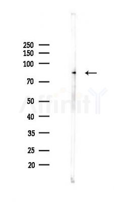 HLCS Antibody - Western blot analysis of lysates from Mouse liver, using HLCS Antibody at 1/1000 dilution.