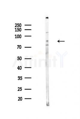 HLCS Antibody - Western blot analysis of lysates from Hela cells(heat-shock,45min treatment), using HLCS Antibody at 1/1000 dilution.