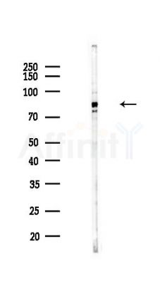 HLCS Antibody - Western blot analysis of lysates from COLO205 cells(heat-shock,45min treatment), using HLCS Antibody at 1/1000 dilution.