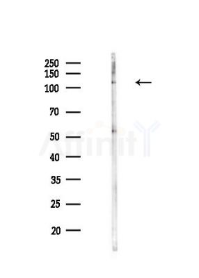 PRDM9 Antibody - Western blot analysis of lysates from Hela cells(heat-shock,45min treatment), using PRDM9 Antibody at 1/1000 dilution.