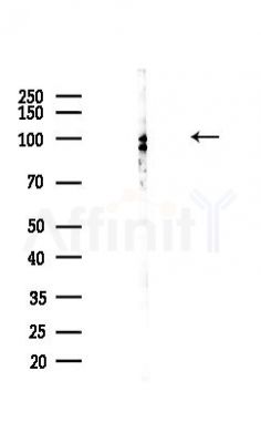 PRDM9 Antibody - Western blot analysis of lysates from COLO205 cells(heat-shock,45min treatment), using PRDM9 Antibody at 1/1000 dilution.