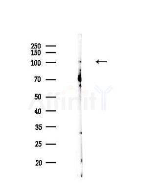 ZC3H12C Antibody - Western blot analysis of lysates from Hela cells(heat-shock,45min treatment), using ZC3H12C Antibody at 1/1000 dilution.