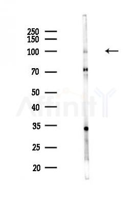 ZC3H12C Antibody - Western blot analysis of lysates from COLO205 cells(heat-shock,45min treatment), using ZC3H12C Antibody at 1/1000 dilution.