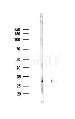 DCUN1D2 Antibody - Western blot analysis of lysates from Mouse liver, using DCUN1D2 Antibody at 1/1000 dilution.