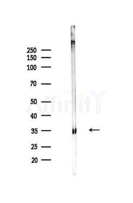 AKR1D1 Antibody - Western blot analysis of lysates from Mouse liver, using AKR1D1 Antibody at 1/1000 dilution.