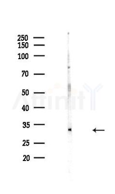UTP11 Antibody - Western blot analysis of lysates from Hela cells(heat-shock,45min treatment), using UTP11 Antibody at 1/1000 dilution.