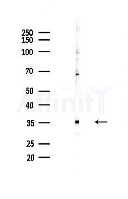 UTP11 Antibody - Western blot analysis of lysates from COLO205 cells(heat-shock,45min treatment), using UTP11 Antibody at 1/1000 dilution.